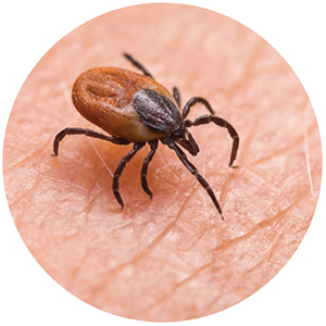 A tick on a human skin surface